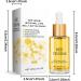 Bee venoms Intestinal detoxs Belly Button Drops Bee venoms Belly Button Drops Bee venoms Oil for Belly Button Bee venoms Drops Tightening And Shaping Bee venoms Lymphatics Drainage Drops Oil - Buy Online on SooperMarket.com