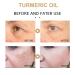 2 Pack Turmeric Dark Spot Corrector Serum - Natural Face Serum for Dark Spots Moisturizing & Repair (30ml) | Best Skin Care Solution - Buy Online on SooperMarket.com