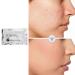 Scar Removal Cream | Smoothing Skin & Reduce Formation of Connective Tissue | Repair Cream for Burn & Old Scars | Easy to Use - Buy Online on SooperMarket.com