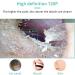 KANDUO Ear Wax Removal Tool - Visual 5.5mm HD Ear Endoscope for Adults & Kids - Buy Online on SooperMarket.com
