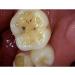 Buy HD Wireless Dental Intraoral Camera - 6MP 6 LED Clear Image for Pet & Human Oral Exams - Buy Online on SooperMarket.com