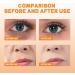 Dajidafu Portable Eye Dark Circle Spray Anti-age Anti-wrinkle Mist Sprays Moisturizing Hydrating Sprayer Wrinkle Remover Skin Care - Buy Online on SooperMarket.com