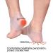 Silicone Gel Heel Socks for Plantar Fasciitis Relief and Skin Care - 2 Pairs - Buy Online on SooperMarket.com
