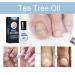 HOPASRISEE Onyxoguard Nail Growth and Repair Serum Onyxoguard Serum Nail Strengthener Nail Growth Serum Nail Growth and Strengthener Nail Serum for Strength and Growth (1) - Buy Online on SooperMarket.com