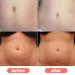 Best Stretch Mark Cream for Pregnancy | Tummy Butter & Belly Butter for Prevention & Repair - Buy Online on SooperMarket.com