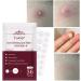 Acne Dressing Spot Patch Acne Paste Transparent Pimple Patch Breathable Painless Acne Treatment Gel Patch Skin Care Absorb Pus Rapid Healing Effective Antibacterial Protection 36 Patches - Buy Online on SooperMarket.com