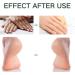 Foot Cream for Cracked Heels and Dry Skin Feet Hard Skin Remover Foot Moisturiser Callus Remover for Feet Nourishes Feet & Hand Foot Care Cream to Improve Elasticity & Smoothen Skin - Buy Online on SooperMarket.com