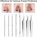 Pinkiou Blackhead Removers and Pimple Extractors Kit - 8-in-1 Skincare Tool for Face and Nose - Buy Online on SooperMarket.com