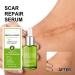 Dajidafu Women Belly Stretch Mark Body Acne Scars Removal Girls Repair Essence Anti-aging Beauty Supplies 30ml - Buy Online on SooperMarket.com