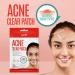 Epielle Acne Clear Patch - Hydrocolloid Pimple Patch for Face & Skin, 4 Pack Acne Spot Treatment Stickers - Cruelty-Free, Two Patch Sizes 8mm & 10mm - Buy Online on SooperMarket.com