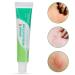15g Portable Anti-Itch Cream: Soothes & Repairs Sensitive Skin - Buy Online on SooperMarket.com