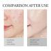 14% Azelaic Acid Cream | Premium Redness Relief Serum for All Skin Types | Niacinamide & Vitamin C | 1 Oz - Buy Online on SooperMarket.com