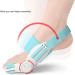 Hallux Valgus Correction: Thickened Silicone Bunion Toe Straighteners for Pain Relief - Day & Night Support - Buy Online on SooperMarket.com
