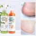 Anushka Foot Peeling Spray Oil | Remove Dead Skin & Calluses Instantly | Exfoliating Hydrating Peel Off Spray (Orange) - Buy Online on SooperMarket.com