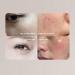 USB Portable Skin Analyzer Portable Skin Analyzer USB Facial Moisture Meter Skin Care Water Oil Tester Digital Moisture Sensor for Beauty Salon - Buy Online on SooperMarket.com