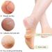 Moisturizing Silicone Socks for Women - 2 Pairs of Anti-Slip Pedicure Socks for Dry Cracked Feet - Soft & Hydrating Skin Color - Buy Online on SooperMarket.com