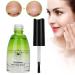 Ultimate Blackhead Removal Kit | Deep Pore Cleanser & Anti-Acne Serum for Face Nose & Chin - 1G - Buy Online on SooperMarket.com