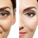 Anti-Aging Eye Gel for Dark Circles, Puffiness, Wrinkles & Skin Firming - Hyaluronic Acid & Aloe Vera - 1.7 fl. oz - Buy Online on SooperMarket.com