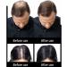 1BAG Hair Building Fibers Instant Hair Loss Treatment Color Powder Conceal Thinning Hair Add Volume For Both Men & Women(Black)  - Buy Online on SooperMarket.com