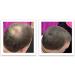 Caboki Hair Loss Concealer Hair Building Fiber 25g (Black) - Buy Online on SooperMarket.com