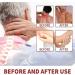 Bee Venom Psoriasis Cream New Zealand Bee Venom Cream Bee Venom Wart and Tag Remover Fast-Acting Relief Bee Venom Cream Psoriasis Cream Soothing Psoriasis Cream (60g) - Buy Online on SooperMarket.com
