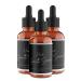 Allurium Hair Growth Serum for Black Women 2023 New Allurium Hair Growth Serum Allurium Hair Growth Serum Anti Hair Loss Nourish Dry Damaged Hair Repair Fast Natural Hair Growth (3 bottles) 3PCS