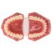 Orthodontic Demonstration Model for Dental Research | Metal Wires & Ceramic Brackets | Teaching Aids for Adults - Buy Internationally - Buy Online on SooperMarket.com