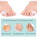 Gel Toe Separators for Overlapping Toes & Hammer Toe Straightener - Bunion Pads Corrector for Women - Pinky Toe Spacers for Bunion Relief - 1 Fl Oz (Purple) - Buy Online on SooperMarket.com