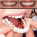 CHNLML Snap On Smile Teeth Veneers - Perfect Whitening & Comfortable Fit (2 Pcs) - Buy Online on SooperMarket.com