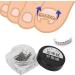 Ingrown Toe Wire Fixer 2 Box Fixer Toenail Correction Corrector Lifter Tool Nail Ingrowing Pedicure Care with 6 Sizes for Nail Toe Straighteners Recover Foot Care Men and Women - Buy Online on SooperMarket.com