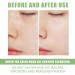 2 Pack Turmeric & Green Tea Clay Stick Face Masks - Organic Vitamin C, Blackhead Cleansing, Deep Pore Cleansing, Skin Brightening, Moisturizing - Buy Online on SooperMarket.com