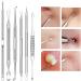 Pimple Popper Tool Kit - 15PCS Blackhead Remover & Extraction Tools for Estheticians - Buy Online on SooperMarket.com
