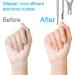 Sularpek 3-in-1 Cuticle Remover Tool Set - Professional Stainless Steel Nail Care Kit for Manicure and Pedicure - Buy Online on SooperMarket.com