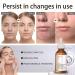 Retinol Serum For Face/Neck/Eyes - Retinol 1% in Squalane 30ml - High-Strength Face Serum for Activate Skin- Anti Aging Facial Serum for Moisturizing Fine Line Skin Repair - Buy Online on SooperMarket.com