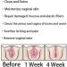 AnnieCare Instant Anti-Itch Detox Slimming Products - Firming Repair Capsules - Set of 2 - Buy Online on SooperMarket.com