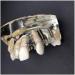 Implant Tooth Template | Oral Simulation Dental Study Model for Teaching - Shop Internationally - Buy Online on SooperMarket.com