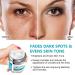 Fast-Acting Dark Spot Remover for Face & Body | Hyperpigmentation & Melasma Corrector | Even Skin Tone | Age Spot Treatment for Men & Women - Buy Online on SooperMarket.com