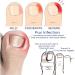 Ingrown Toenail Treatment and Removal Relief Oil - Nail Growth and Fungal Corrector - Buy Online on SooperMarket.com