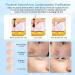 Skin Tag Removal Pen Best Skin Tag Remover Pen 9 Modes LCD Display & Spotlight Portable Rechargeable Skin Tags Removal kit with Replaceable Needles for Wart Freckle Dark Spot - Buy Online on SooperMarket.com