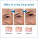 Hyalu B5 Serum Hyaluronic Acid B5 Serum Anti Aging Serum Face Serum Concentrate Hyaluronic Acid Serum for Face - Anti Aging Instant Face Firming & Plumping Face Fade Fine Lines 30ml - Buy Online on SooperMarket.com