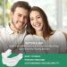 KMIIMET Anti-Snoring Mouthpiece - Comfortable Mouth Guard for Men/Women - Snoring Solution for a Better Night's Sleep - Buy Online on SooperMarket.com