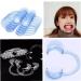 Zonster Dentist Retractor Mouth Opener for C-Shape Teeth Whitening - Intraoral Cheek & Lip Retractors | International Shipping - Buy Online on SooperMarket.com