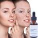 Luxsea Salicylic Acid 2% Serum for Clearer Skin - Shrinks Pores, Treats Rosacea, Blackheads, and Acne - Gentle Exfoliating Hyaluronic Acid Formula - Buy Online on SooperMarket.com