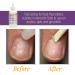 ProLinc Cuticle Eliminator - 4 fl oz - Buy Online on SooperMarket.com