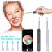 PLGEBR Ear Wax Remover Wireless Otoscope Earwax Removal Tool Camera WiFi Endoscope Cleaner with Visual LED Light Ear Scope HD Ear White+black free size - Buy Online on SooperMarket.com