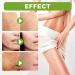 Dajidafu Women Belly Stretch Mark Body Acne Scars Removal Girls Repair Essence Anti-aging Beauty Supplies 30ml - Buy Online on SooperMarket.com