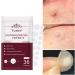 Acne Dressing Spot Patch Acne Paste Transparent Pimple Patch Breathable Painless Acne Treatment Gel Patch Skin Care Absorb Pus Rapid Healing Effective Antibacterial Protection 36 Patches - Buy Online on SooperMarket.com