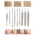 OETUIOW 9pcs Blackhead Remover Tool Kit - Professional Pimple Comedone Extractor Set for Pimples, Blackheads, Zit Removal - Forehead, Facial, and Nose - Buy Online on SooperMarket.com