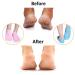 Moisturizing Gel Socks - 2 Pairs of Reusable Soft Socks with Essential Oil Treatment for Dry Skin Pink & Blue - Buy Online on SooperMarket.com