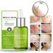 Goopgen Advanced Scar Repair Serum 30ML - Nature Scar Treatment - Scar Removal Serum for All Types of Scars (1PC) - Buy Online on SooperMarket.com